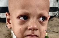  فریاد گرسنگی در چشمان یک کودک (2)