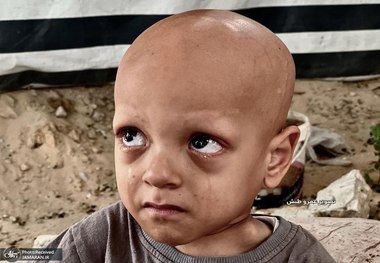 تصاویری دردناک/ فریاد گرسنگی در چشمان یک کودک؛ عبدالله ابو زرقة، تصویری از رنج بی‌پایان غزه