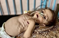 وخامت وضعیت سلامت کودک سه‌ساله غزه‌ای بر اثر سوءتغذیه و محاصره (6)