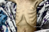 شهادت کودک فلسطینی بر اثر گرسنگی در جنوب غزه (4)