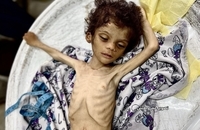 شهادت کودک فلسطینی بر اثر گرسنگی در جنوب غزه (9)