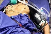 آخرین خبر از وضعیت قهرمان پرورش اندام ایران
