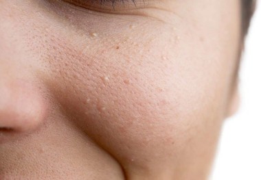 معرفی راحت ترین روش برای اخذ نوبت از دکتر پوست