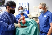 عجیب‌ترین عمل جهان انجام شد/ قلب یک خوک در بدن یک مرد 57 ساله! + فیلم و تصاویر